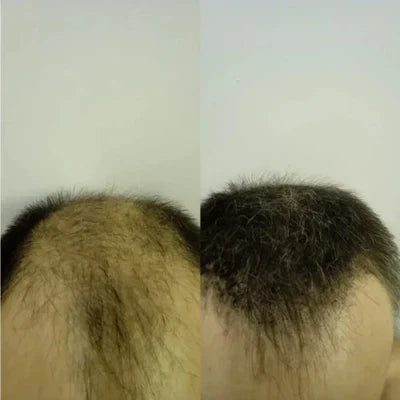 Fibras Capilares Para La Calvicie Cabell 2x1