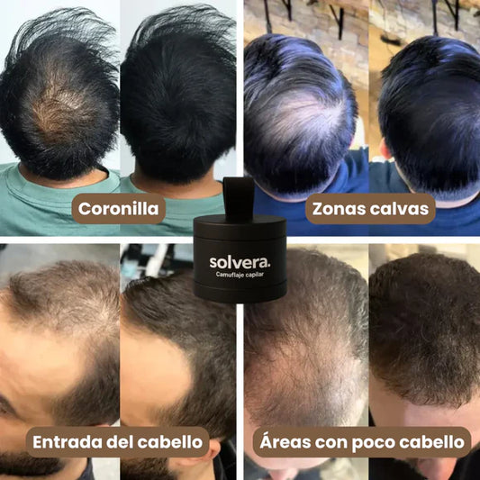 Fibras Capilares Para La Calvicie Cabell 2x1